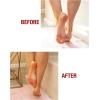 imageKerasal Intensive Foot Repair Skin Healing Ointment for Cracked Heels and Dry Feet 1 oz  2 Count Pack of 2Foot Repair  Gel Socks