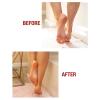 imageKerasal Intensive Foot Repair Skin Healing Ointment for Cracked Heels and Dry Feet 1 oz  2 Count Pack of 2Foot Repair  Gel Socks