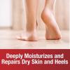 imageKerasal Intensive Foot Repair Skin Healing Ointment for Cracked Heels and Dry Feet 1 oz  2 Count Pack of 2Nighttime Foot Repair