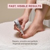 image:imageKerasal Restore amp Repair Nail Care Brush  Controlled Nail Repair for Damaged Nails Quickly Improves Appearance and Smooths Uneven Texture 043 fl oz Includes 2 Applicators086 Fl Oz Pack of 1