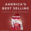 image:imageKerasal Restore amp Repair Nail Care Brush  Controlled Nail Repair for Damaged Nails Quickly Improves Appearance and Smooths Uneven Texture 043 fl oz Includes 2 Applicators033 Fl Oz Pack of 2