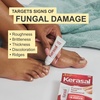 image:imageKerasal Restore amp Repair Nail Care Brush  Controlled Nail Repair for Damaged Nails Quickly Improves Appearance and Smooths Uneven Texture 043 fl oz Includes 2 Applicators033 Fl Oz Pack of 1